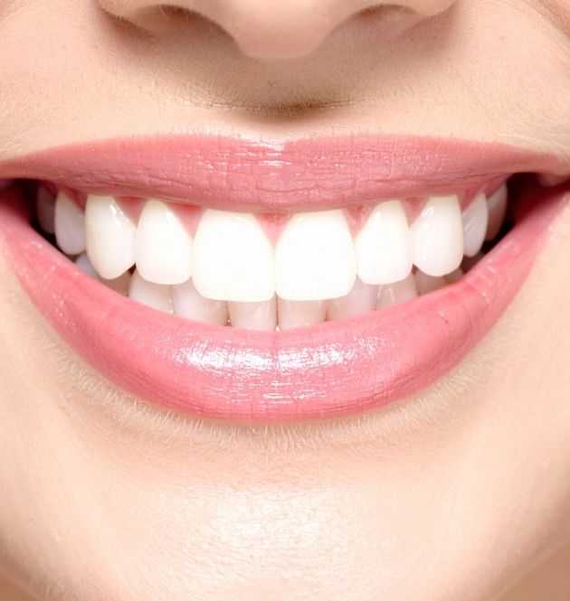 diseño de sonrisa cerca de madrid