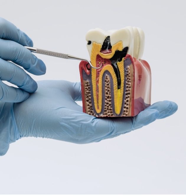 endodoncia madrid
