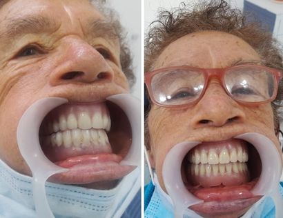 odontologo economico en madrid