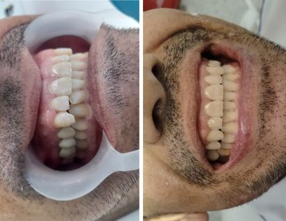 odontologo en madrid cundinamarca
