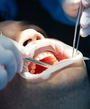 odontologo particular en madrid