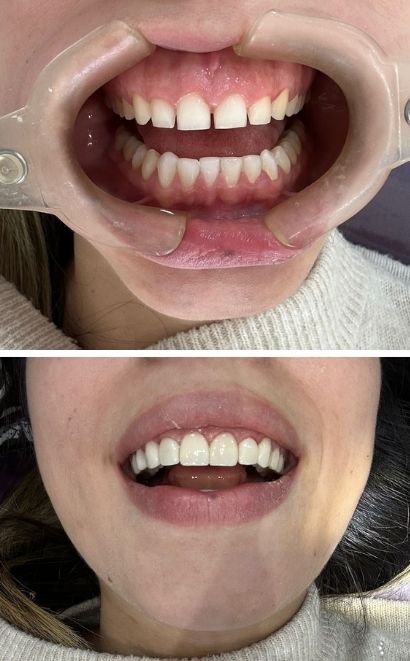 odontologos profesionales en madrid cundinamarca
