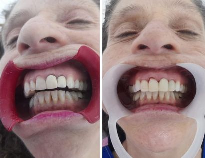 odontologos profesionales en madrid