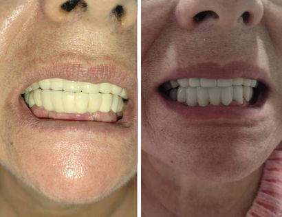 odontologos profesionales madrid
