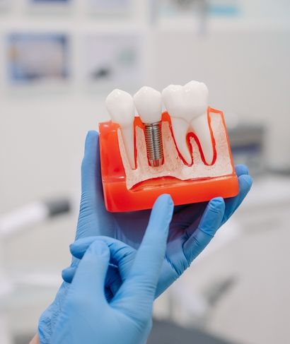 odontologos recomendados madrid