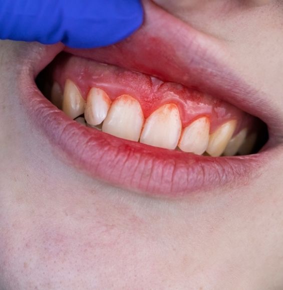 periodoncia madrid