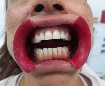 servicio de limpieza dental